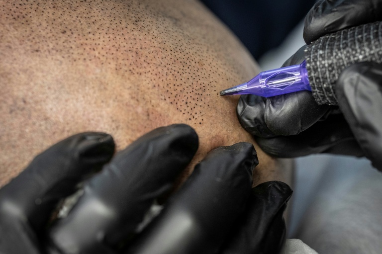 Remy, tatoueur professionnel, réalise une intervention de micropigmentation du cuir chevelu sur un client, dans son studio de Ginowan, à Okinawa au Japon, le 19 mai 2026