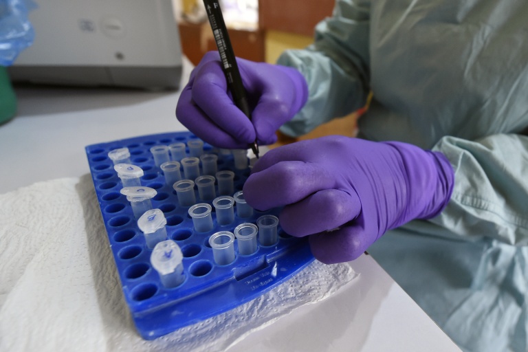 Au laboratoire de l’Institut de recherche et de lutte contre la fièvre de Lassa, à l’hôpital universitaire spécialisé d’Irrua, à Irrua, dans l’État d’Edo, au centre-ouest du Nigeria, le 6 mars 2018