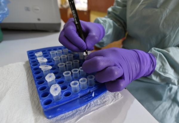 Au laboratoire de l’Institut de recherche et de lutte contre la fièvre de Lassa, à l’hôpital universitaire spécialisé d’Irrua, à Irrua, dans l’État d’Edo, au centre-ouest du Nigeria, le 6 mars 2018