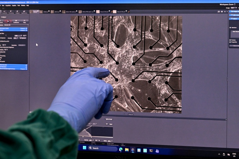 Vue microscopique de  neurones cultivés en laboratoire dans les locaux de l'entreprise australienne Cortical Labs à Melbourne, le 5 mai 2026