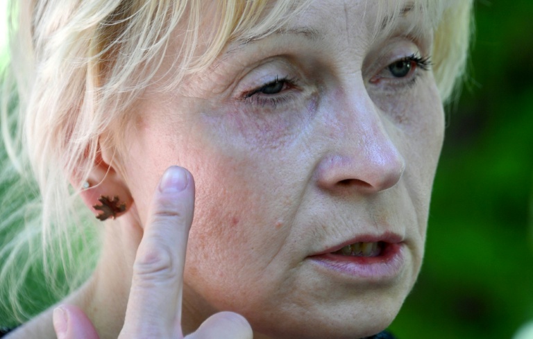Oksana Tikhaïa, victime d'une opération ratée de chirurgie esthétique, montre son oeil à Bichkek, le 15 mai 2026 au Kirghizstan