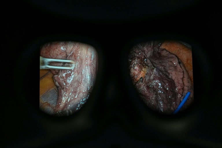 Le gouvernement s'est fixé pour objectif que la chirurgie robot-assistée soit utilisée dans neuf interventions par cœlioscopie sur dix en Angleterre d'ici à 2035