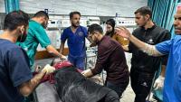 Des médecins s'occupent d'un blessé après une attaque israélienne à l'hôpital Kamal Adwan à Beit Lahia dans le nord de la bande de Gaza, le 21 novembre 2024