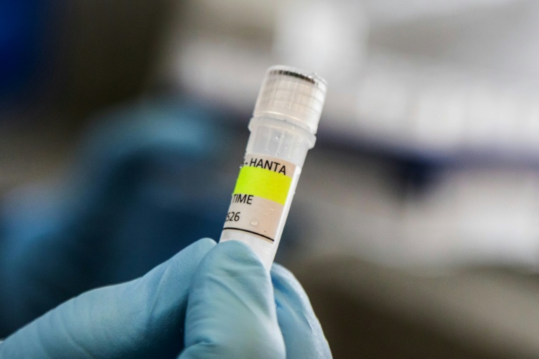 Un tube utilisé pour le diagnostic de l'hantavirus des Andes, à l'institut Malbrán de Buenos Aires, le 6 mai 2026. Photo transmise par le ministère de la Santé argentin