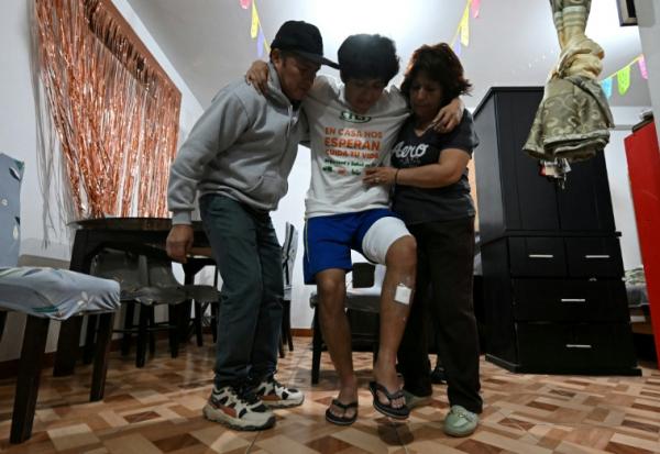 L'étudiant Angelo Nael Genti, blessé lors des manifestations du mouvement Génération Z le 15 octobre à Lima, montre ses blessures lors d'une interview avec l'AFP à son domicile à Ventanilla, au Pérou, le 19 octobre 2025