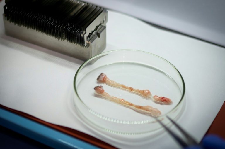 Deux biopsies de tissu adipeux prélevées sur un ours polaire, dans un laboratoire du navire brise-glace scientifique Kronprins Haakon», dans l'archipel du Svalbard, le 9 avril 2025