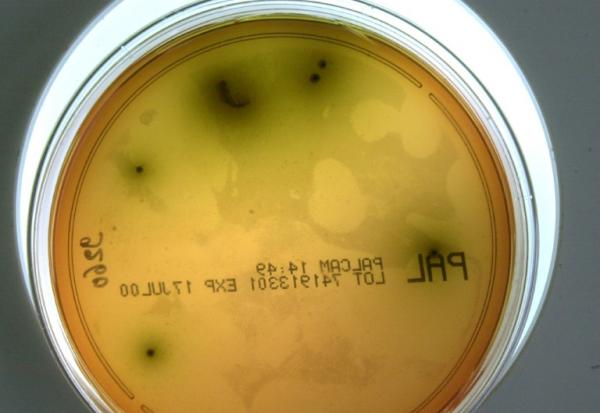 Gros plan d'une souche de listeria pris le 10 mai 2000 au laboratoire d'analyse départementale de la Manche à St Lo