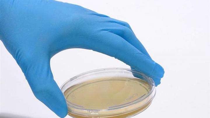 bioMérieux : à suivre demain