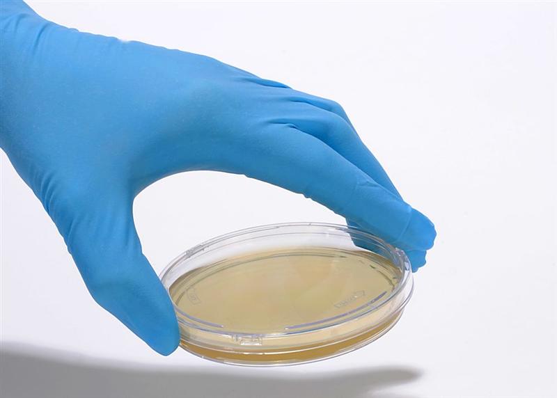 bioMérieux : marquage CE IVDR de Classe D pour deux tests