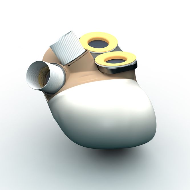 Carmat : retrait de la cote confirmé