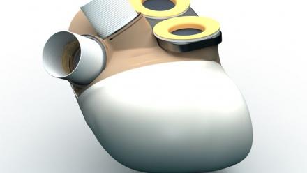 Le Tribunal des activités économiques de Versailles a retenu l'offre de reprise en plan de cession de Carmat SAS