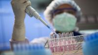 Sanofi : investit dans la biotech américaine InduPro